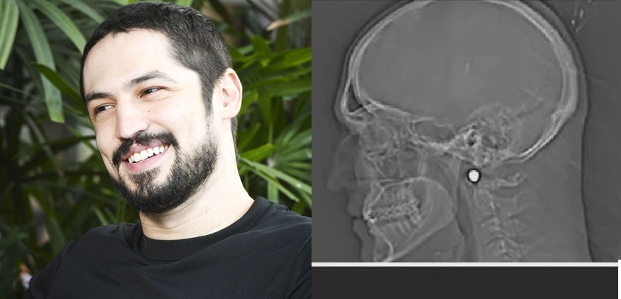 Gabriel Leone exibe tomografia de acidente em Hamlet como nova foto de perfil do WhatsApp