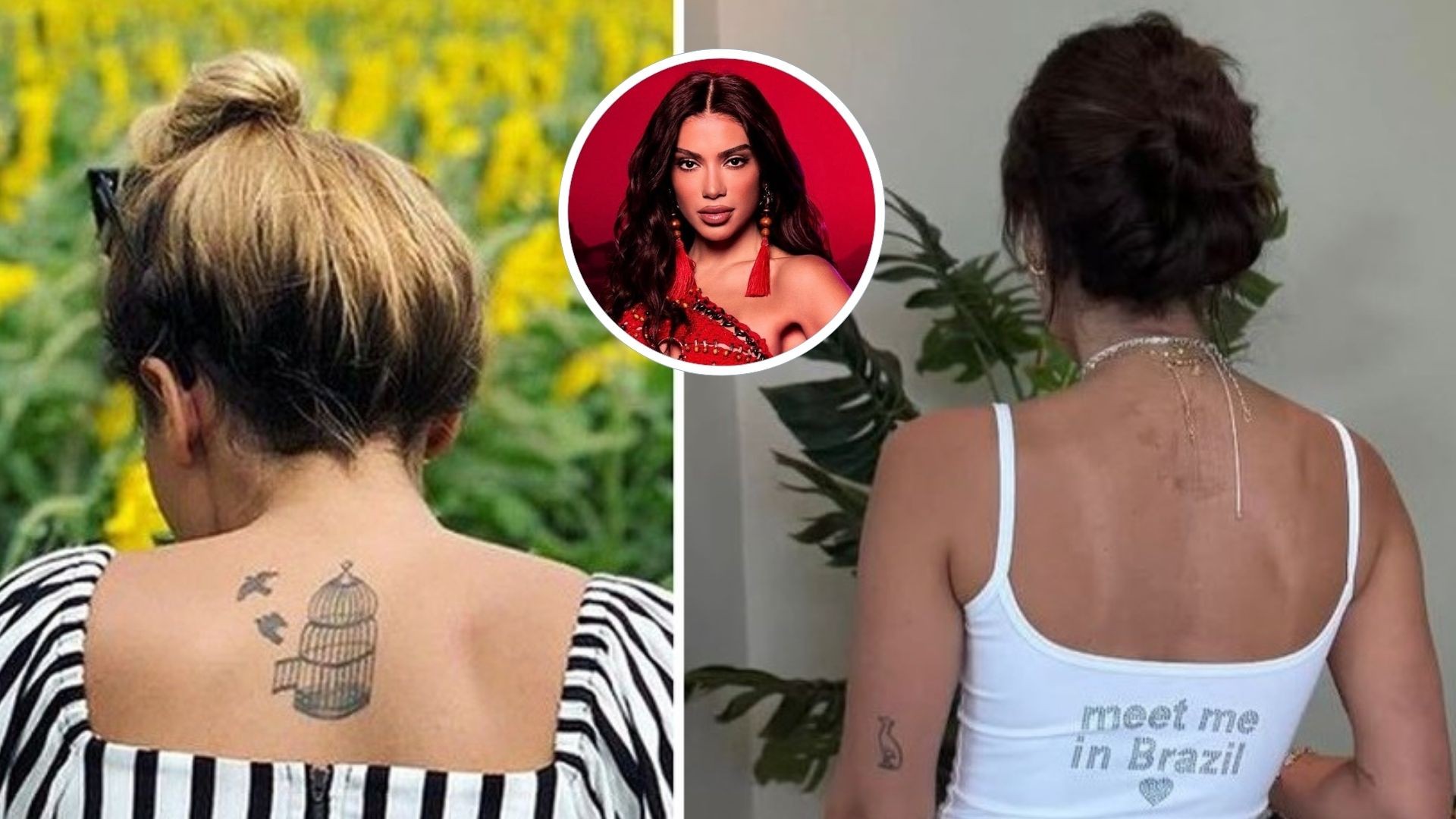 Anitta inicia remoção de tatuagem antiga nas costas