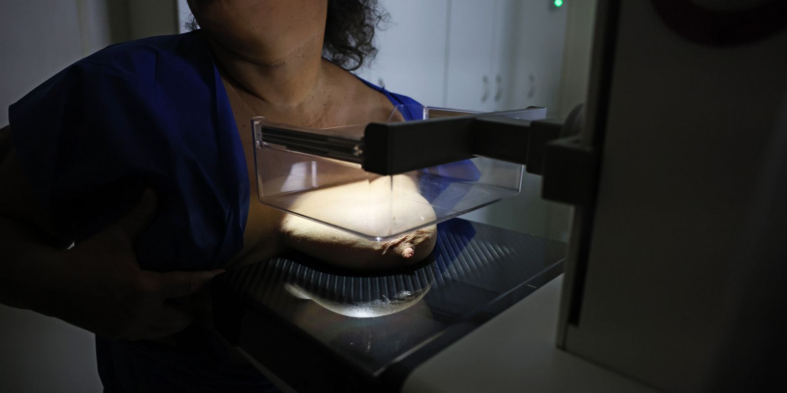ANS propõe obrigatoriedade de mamografia digital nos planos de saúde sem limite de idade