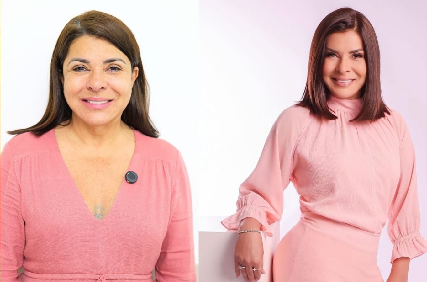 Mara Maravilha celebra 'autoestima renovada' após lift facial natural