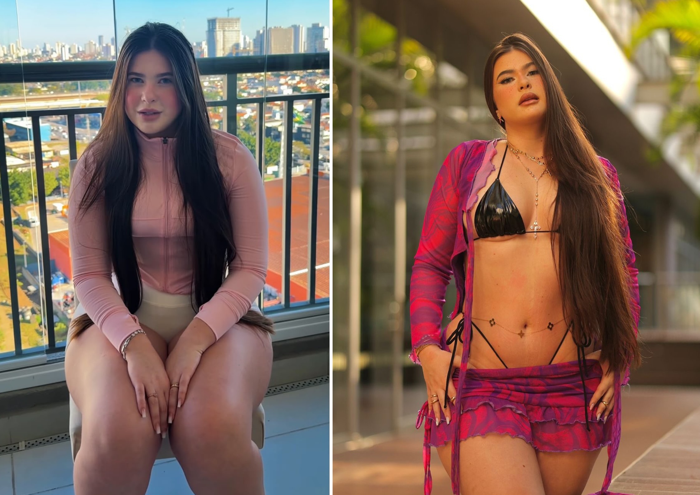 Após perder 30 kg, noiva de Gordão da XJ revela diagnóstico de lipedema