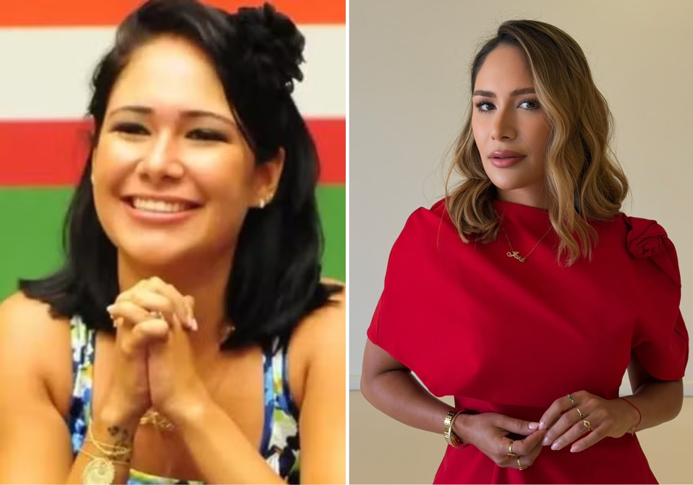 Ex-BBB Jake Leal relata dores intensas provocadas por bruxismo grave