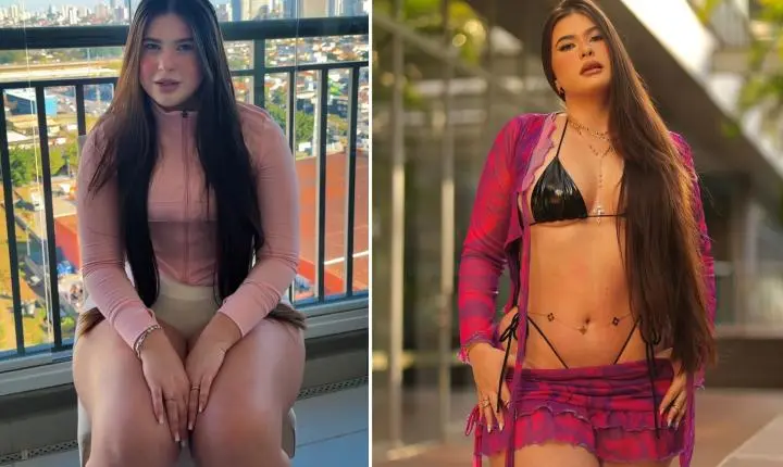 Após perder 30 kg, noiva de Gordão da XJ revela diagnóstico de lipedema